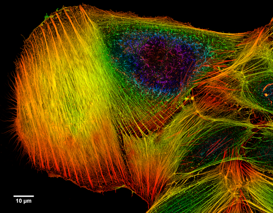 Image Deconvolution: How it works and how to use it for microscopy