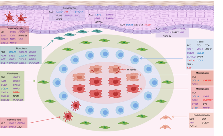 Figure showing a graphic representation of a leprosy granuloma with antimicrobial gene expression of various cell types shown.