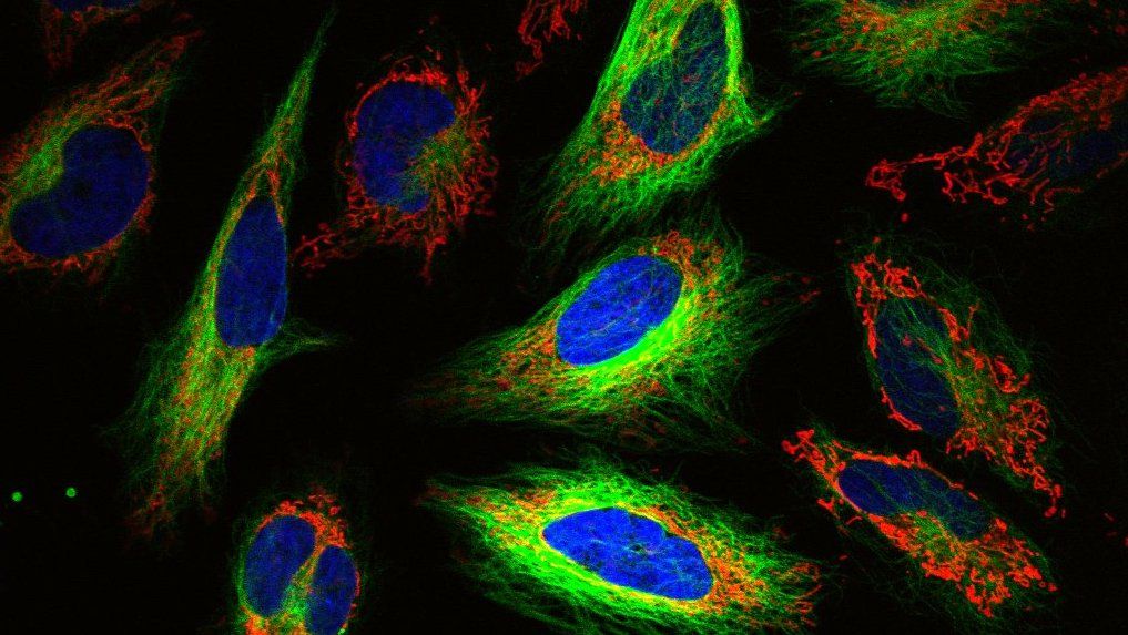Fluorescent stained HeLa cells.