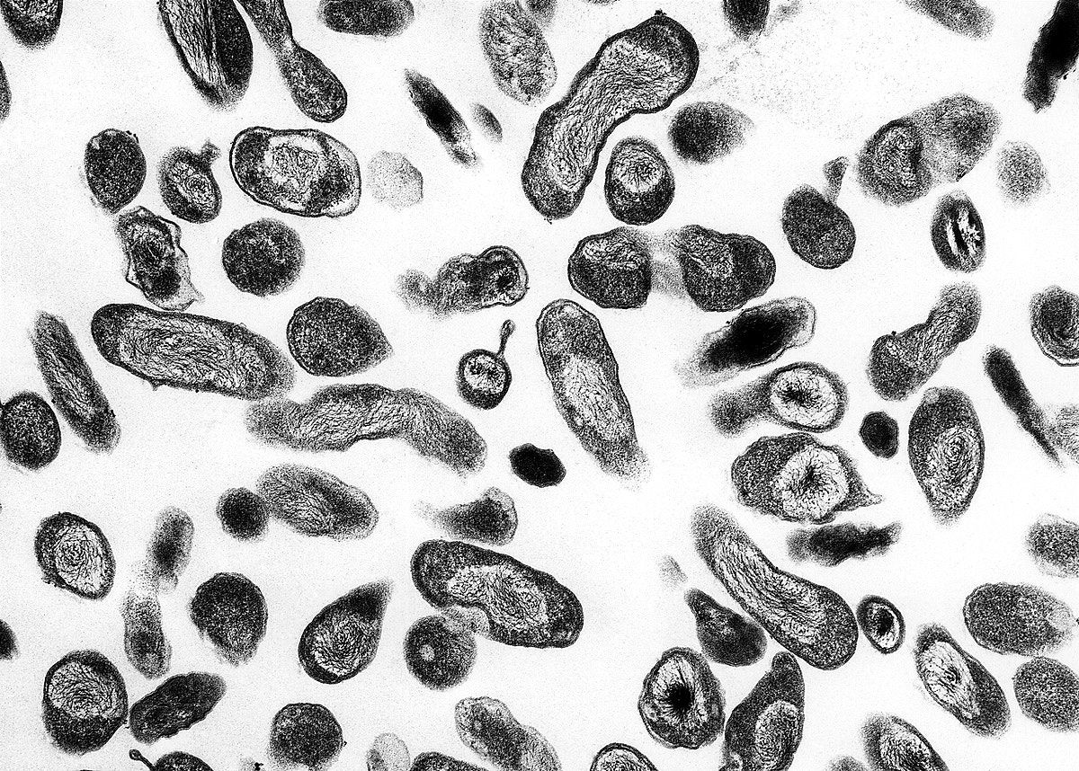 Coxiella burnetii bacteria viewed under transmission electron microscope.