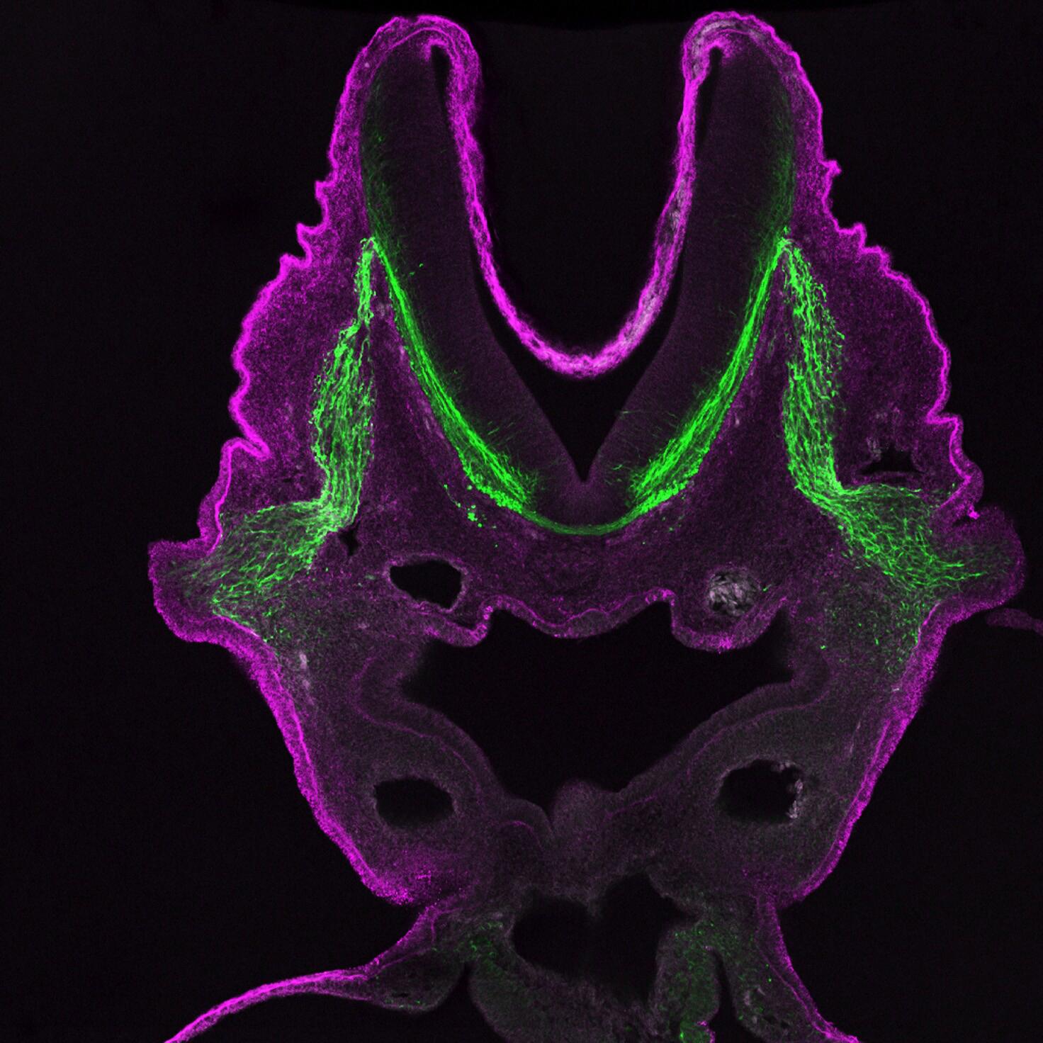  A developing cranial ganglion viewed under a fluorescent microscope.