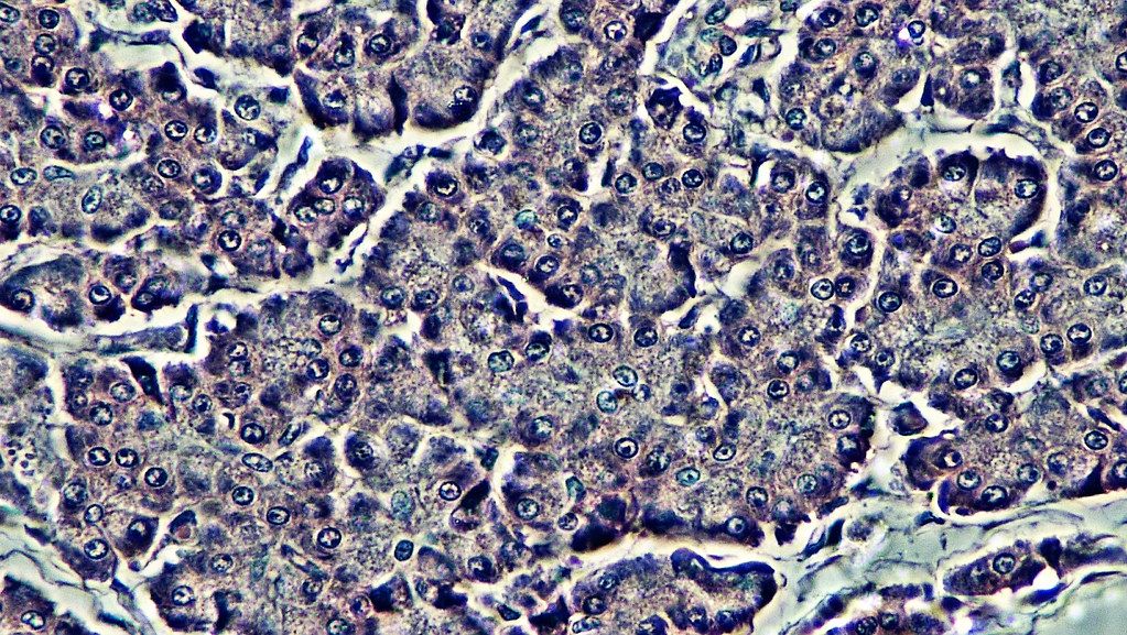 Intercalated and intralobular ducts of a pancreas viewed under a phase contrast microscope.