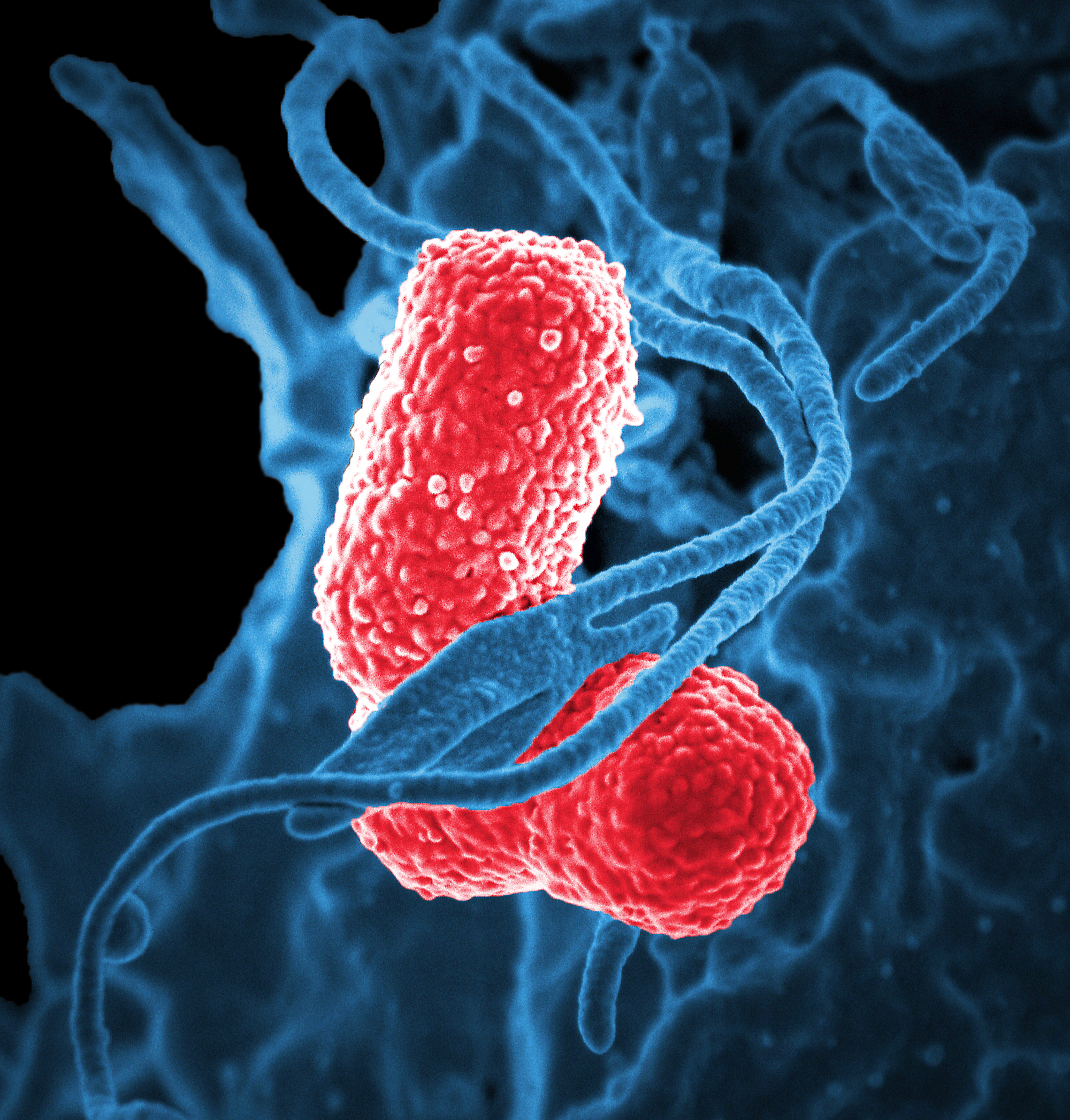 Klebsiella pneumoniae bacteria viewed through a scanning electron microscope.