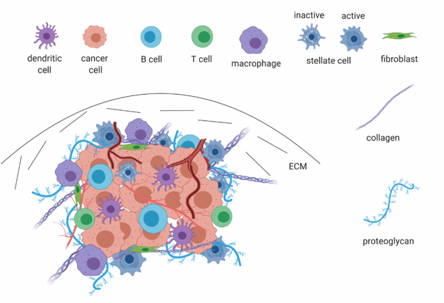 Figure showing major cell types in the tumor microenvironment of pancreatic ductal adenocarcinoma.
