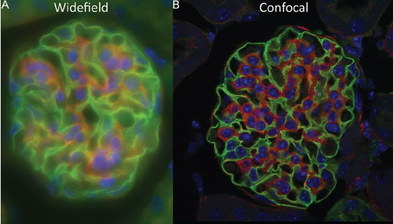 Confocal and epifluorescence images of a single sample