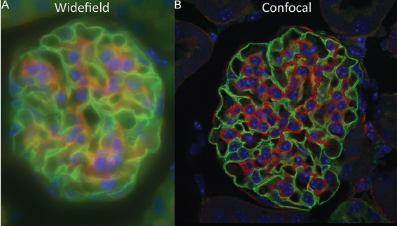 From Actin to Z-stacks: The Imaging Journey