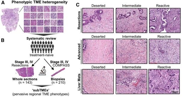 Of tumors and TMEs: new findings in pancreatic cancer spatial heterogeneity