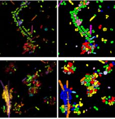 Mapping the microbiome: FISH-based approaches for microbial community visualization