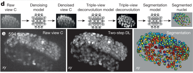 Triple Threat: AI-assisted Multiview Confocal Imaging