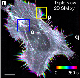 Super-resolution microscopy image generated through multiview 2D SIM.