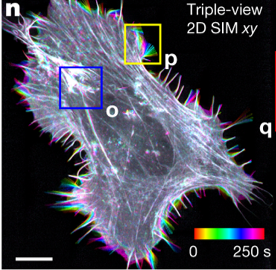 Triple Threat: AI-assisted Multiview Confocal Imaging