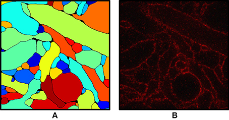 Figure 5: Cell boundary segmentation of 2D slices of expanded neuronal tissue