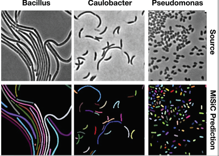 Instance segmentation of different bacterial strains