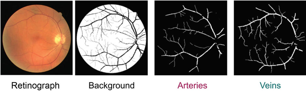 Semantic vs. Instance Segmentation: Applications for Biology