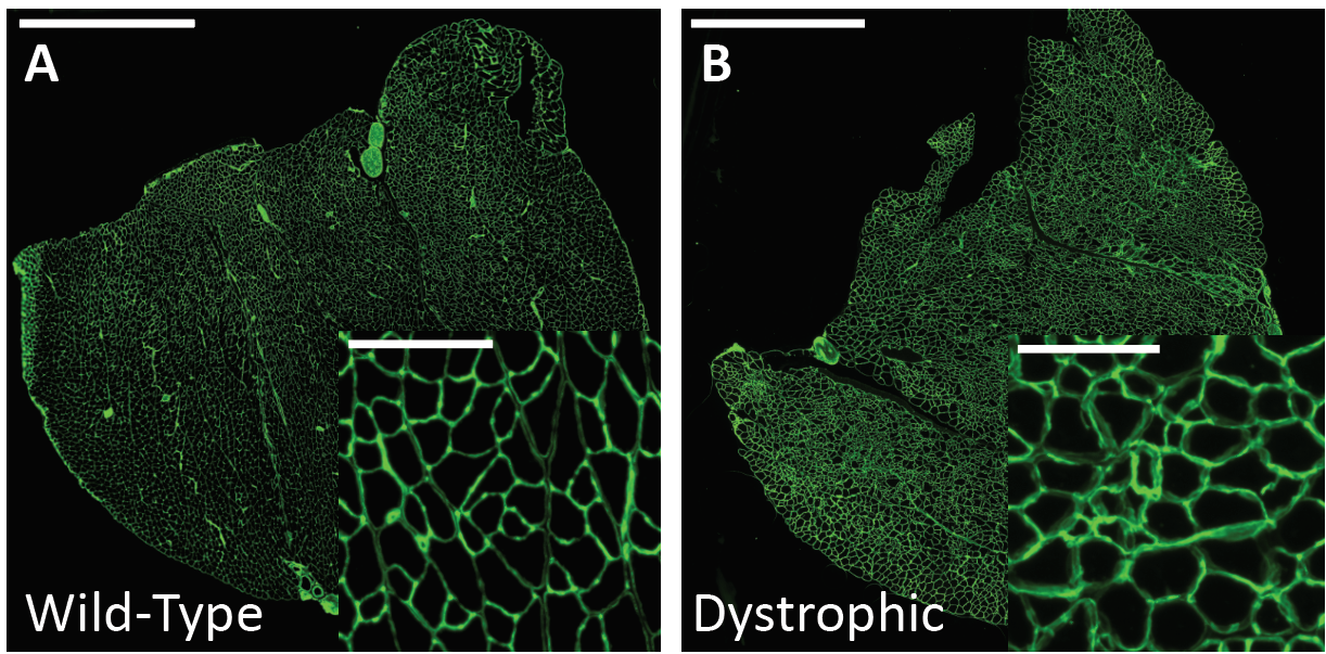 laminin stain of healthy and dystrophic muscle