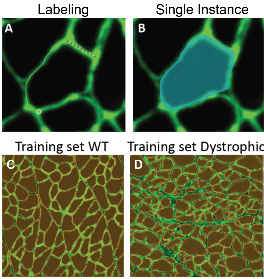 images of laminin stained muscle fibers with manual outlines overlaid