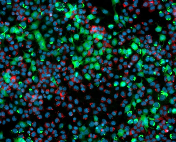 Open-source image analysis software for microscopy